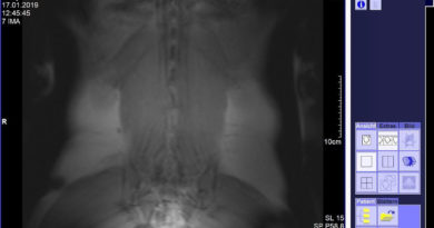 Computertomographie aus der Radiologie Aurich